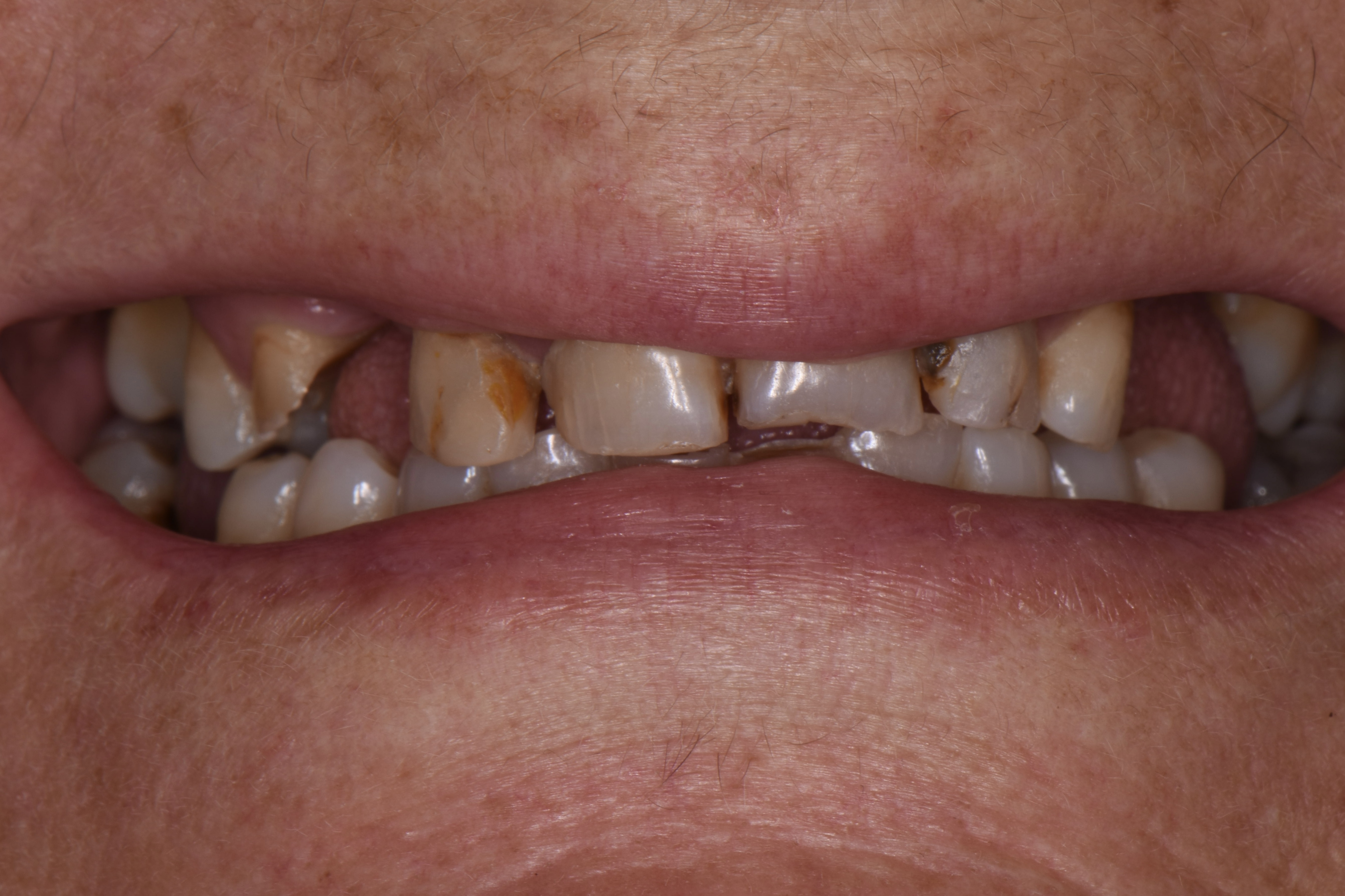 Clinical photograph before